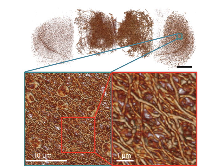 果蠅全腦多巴胺神經多尺度圖像(上)，細部的神經結構(左下)，以及放大展現出非常複雜、但可經由新顯微術辨識的神經網路(右下)。圖│陳壁彰